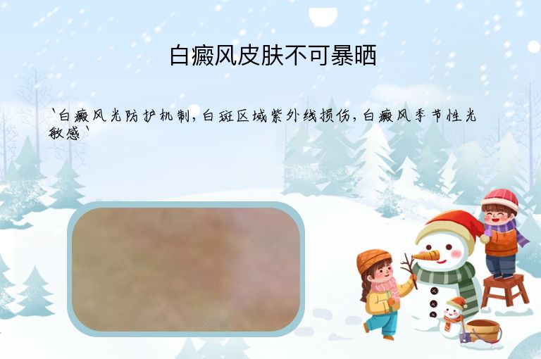 白癜风皮肤不可暴晒