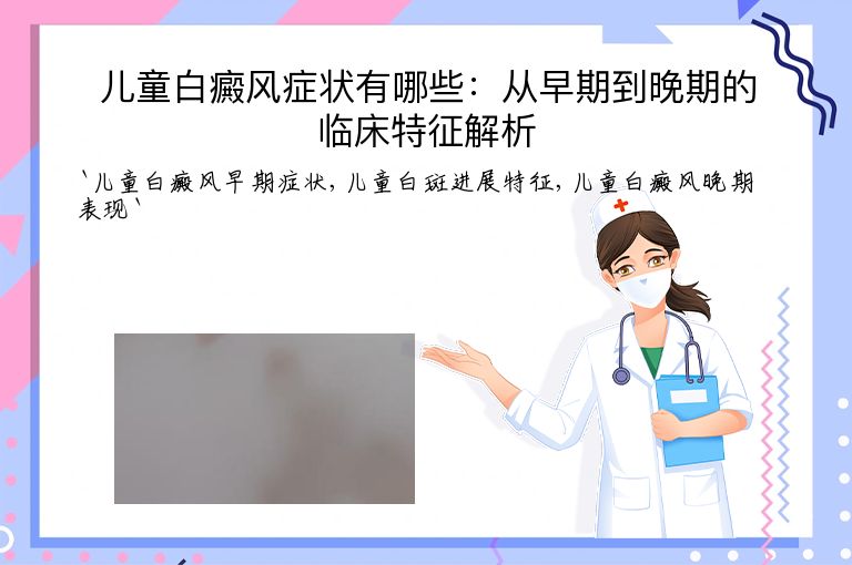 儿童白癜风症状有哪些：从早期到晚期的临床特征解析