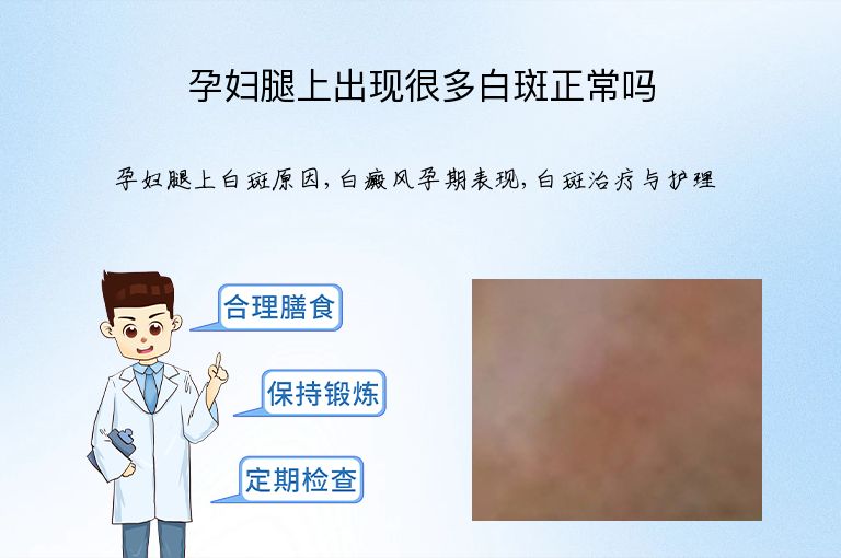 孕妇腿上出现很多白斑正常吗”