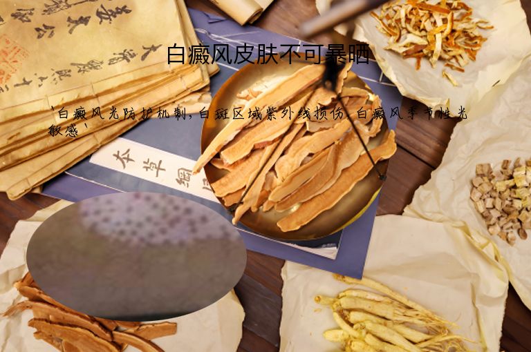 白癜风皮肤不可暴晒