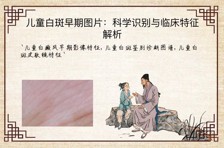 儿童白斑早期图片:科学识别与临床特征解析