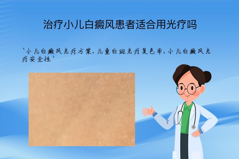 治疗小儿白癜风患者适合用光疗吗