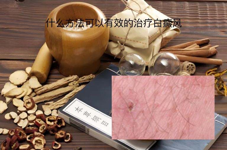 https://www.bdfsjzyy.com/d/file/p/51c05d33fb9de37fd04decffb7baea4d.jpeg