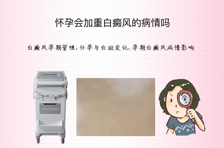 怀孕会加重白癜风的病情吗”