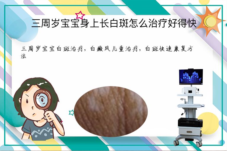 三周岁宝宝身上长白斑怎么治疗好得快”