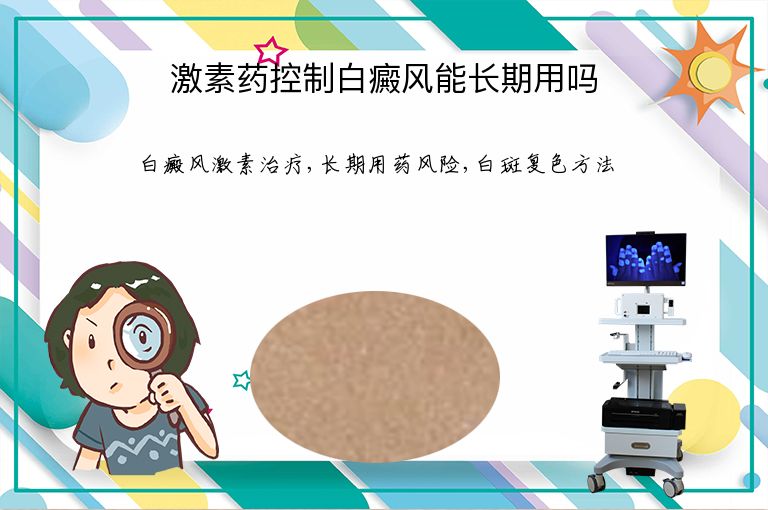 激素药控制白癜风能长期用吗”