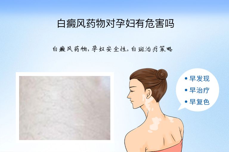 白癜风药物对孕妇有危害吗”