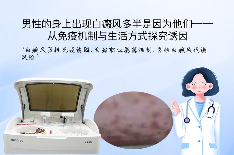 男性的身上出现白癜风多半是因为他们——从免疫机制与生活方式探究诱因