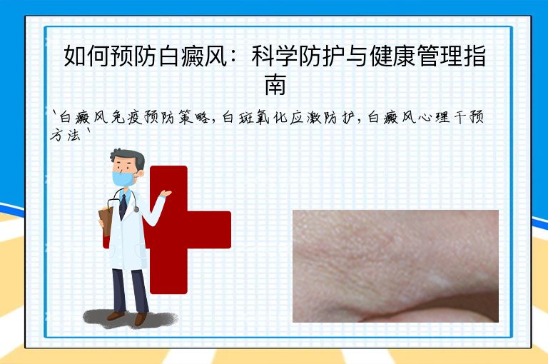 如何预防白癜风:科学防护与健康管理指南