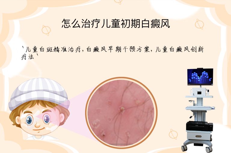 怎么治疗儿童初期白癜风”