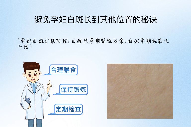 避免孕妇白斑长到其他位置的秘诀