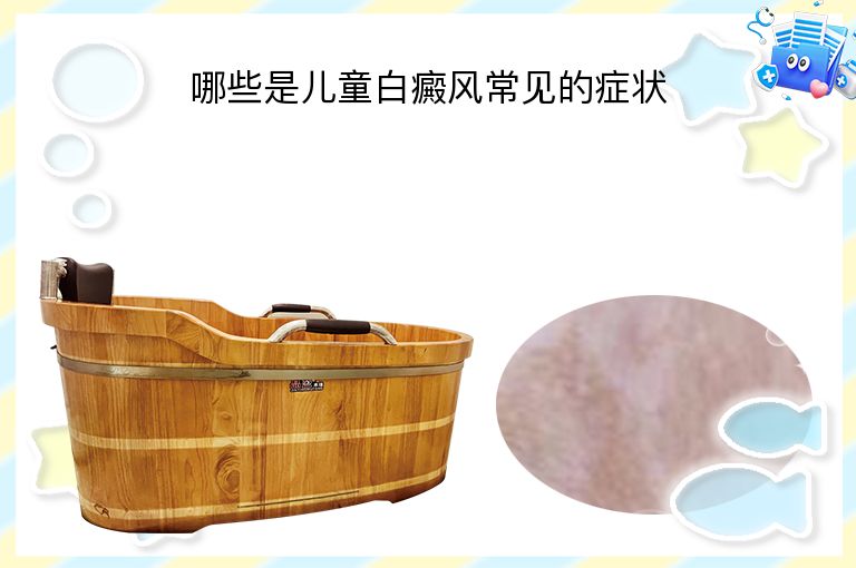 哪些是儿童白癜风常见的症状
