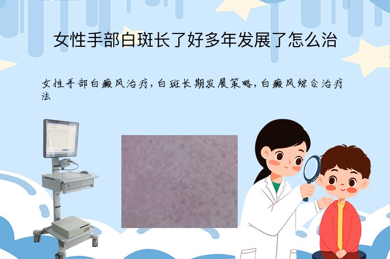 女性手部白斑长了好多年发展了怎么治”