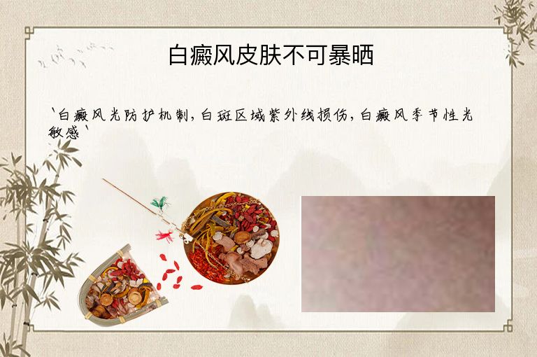 白癜风皮肤不可暴晒