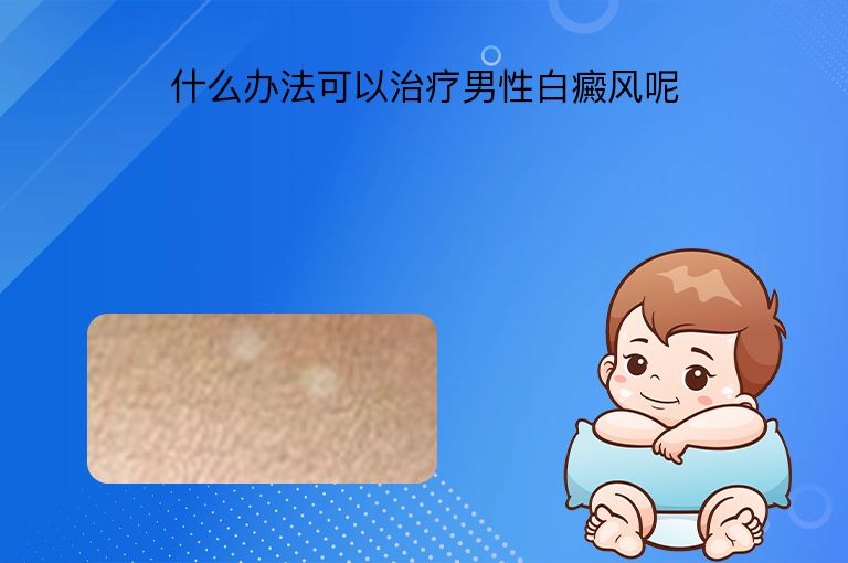 什么办法可以治疗男性白癜风呢”