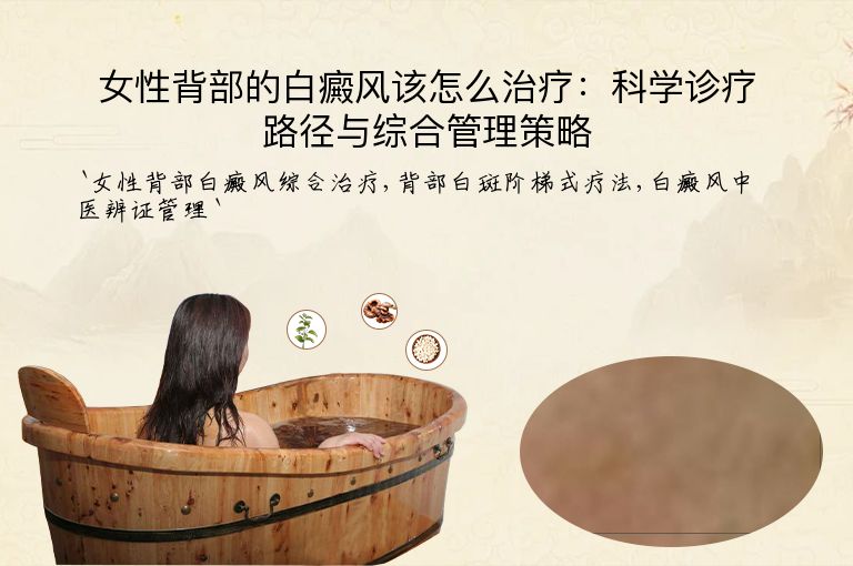 女性背部的白癜风该怎么治疗：科学诊疗路径与综合管理策略