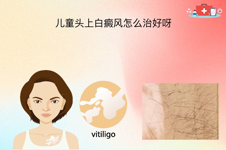 儿童头上白癜风怎么治好呀”