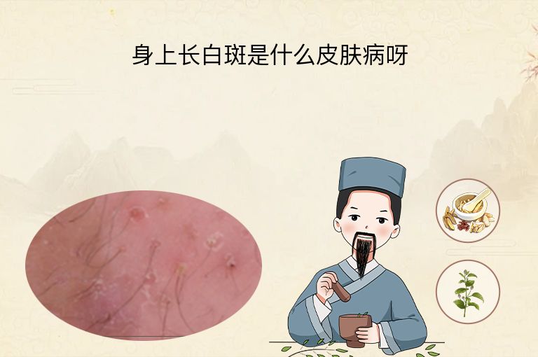 身上长白斑是什么皮肤病呀