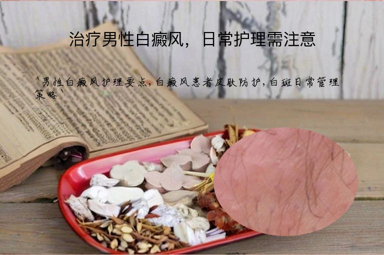治疗男性白癜风,日常护理需注意