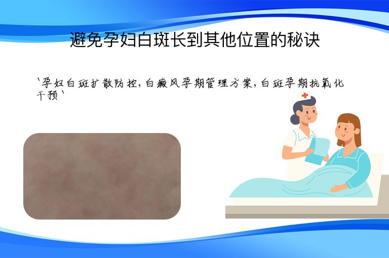 避免孕妇白斑长到其他位置的秘诀”