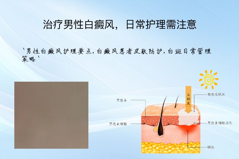 治疗男性白癜风，日常护理需注意