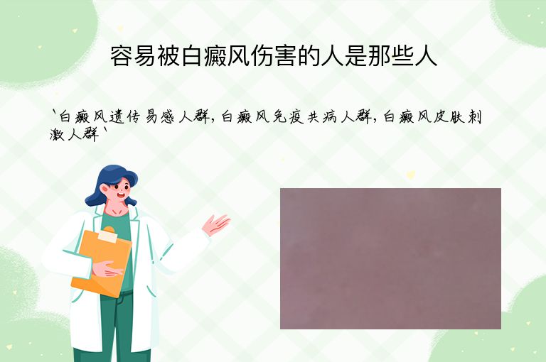 容易被白癜风伤害的人是那些人”