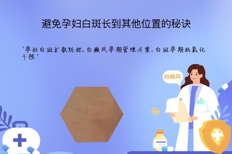 避免孕妇白斑长到其他位置的秘诀