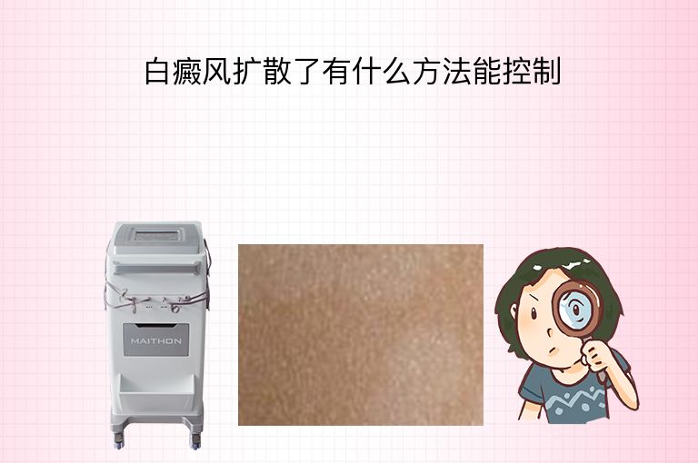 白癜风扩散了有什么方法能控制”