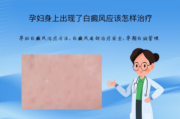 孕妇身上出现了白癜风应该怎样治疗”