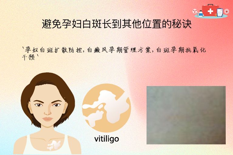 避免孕妇白斑长到其他位置的秘诀