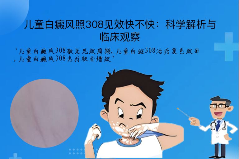 儿童白癜风照308见效快不快：科学解析与临床观察