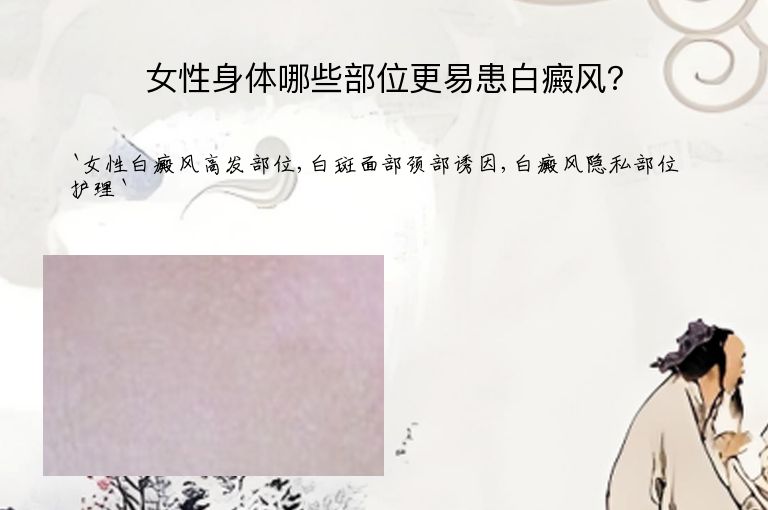 女性身体哪些部位更易患白癜风？”