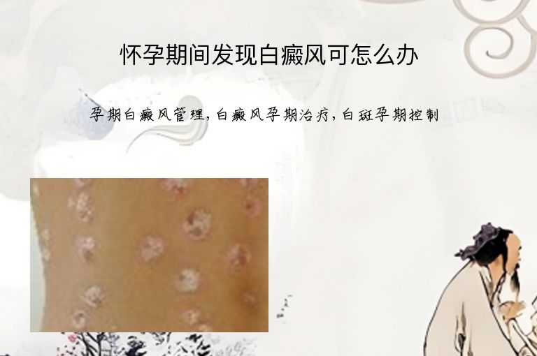 怀孕期间发现白癜风可怎么办”