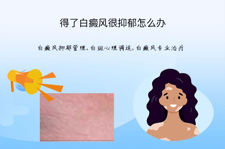 得了白癜风很抑郁怎么办”
