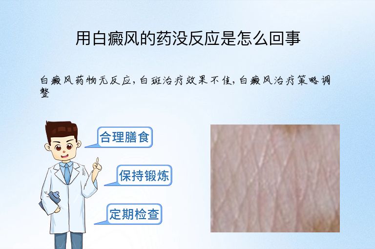 用白癜风的药没反应是怎么回事”