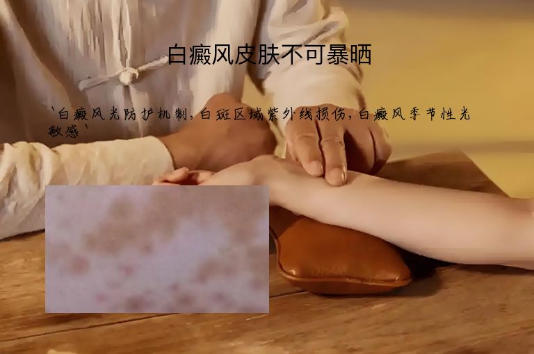 白癜风皮肤不可暴晒