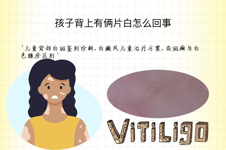 孩子背上有俩片白怎么回事