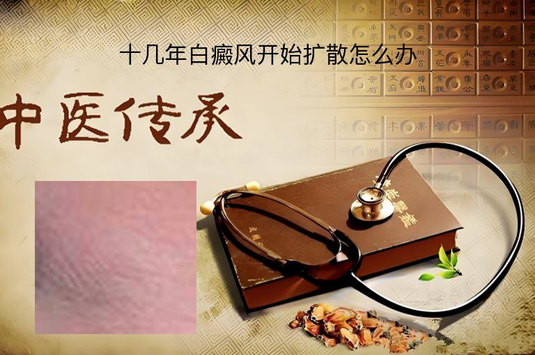 https://www.bdfsjzyy.com/d/file/p/0c35867ce0cf48b515fd265a79f3e917.jpeg