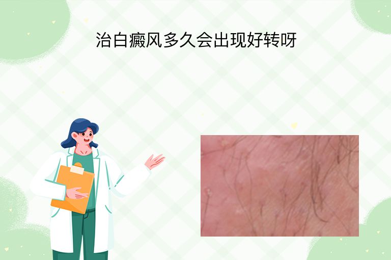 https://www.bdfsjzyy.com/d/file/p/8a6f608a7faa7e49011e85d6e3b8d4be.jpeg