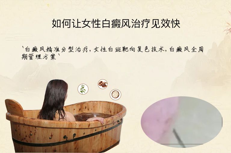 https://www.bdfsjzyy.com/d/file/p/8a59b5d02e2ab768556b177ae52a6f3d.jpeg