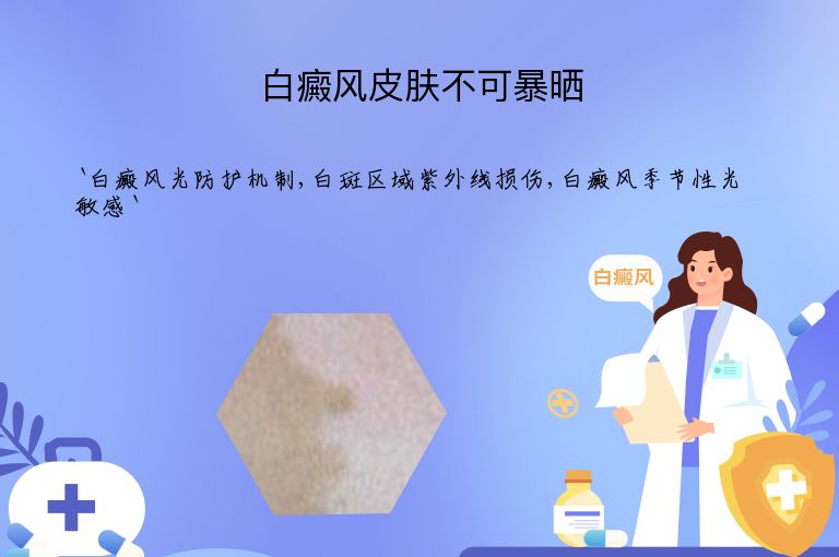 白癜风皮肤不可暴晒