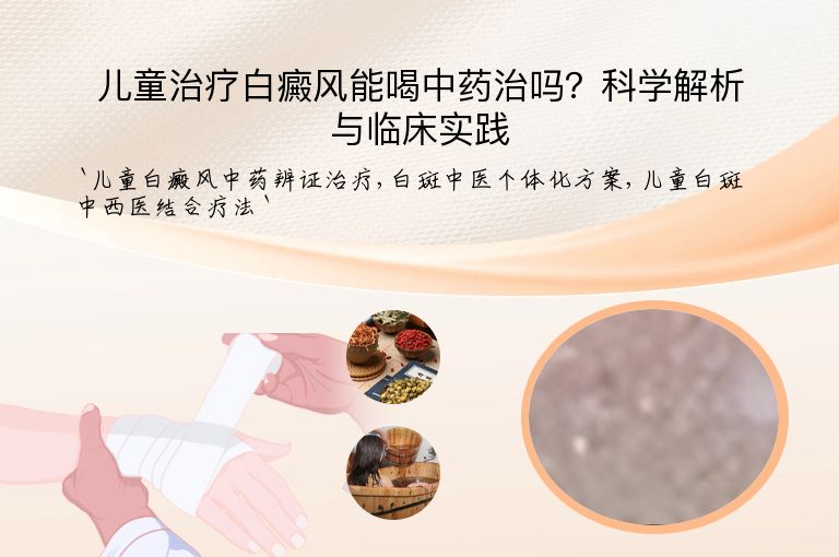 儿童治疗白癜风能喝中药治吗？科学解析与临床实践”