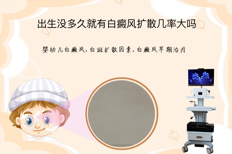 https://www.bdfsjzyy.com/d/file/p/0b9fd22e90be74418d2c5f29063287e5.jpeg