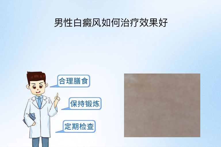 男性白癜风如何治疗效果好”