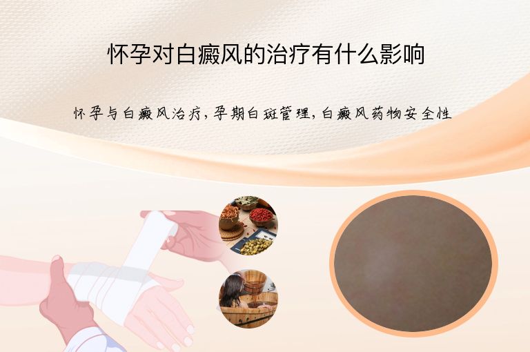怀孕对白癜风的治疗有什么影响”