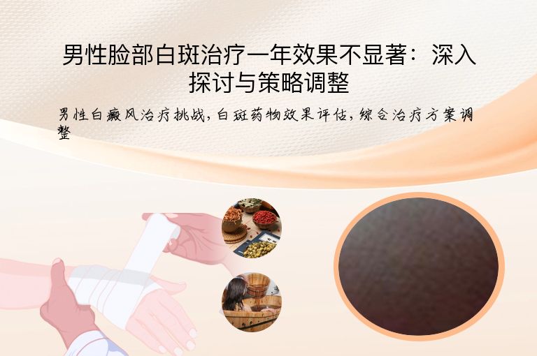 男性脸部白斑治疗一年效果不显著:深入探讨与策略调整”