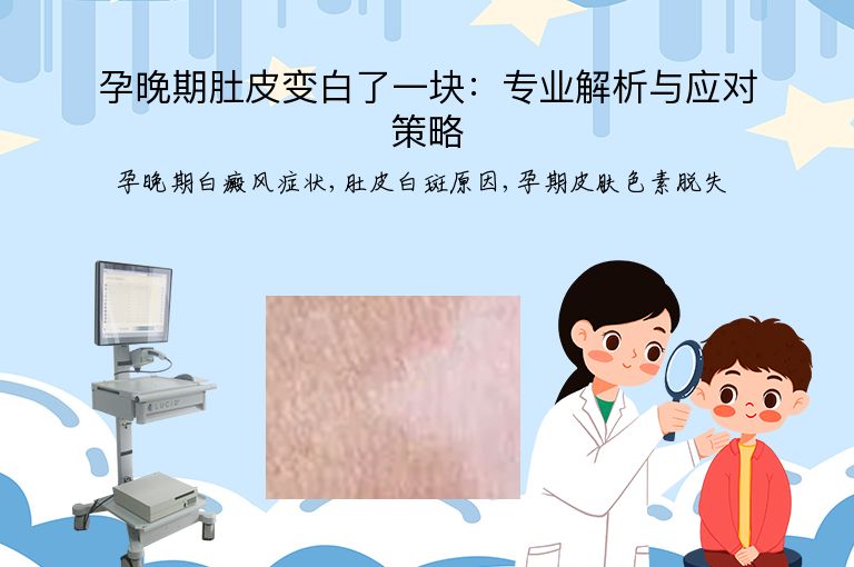 孕晚期肚皮变白了一块：专业解析与应对策略”