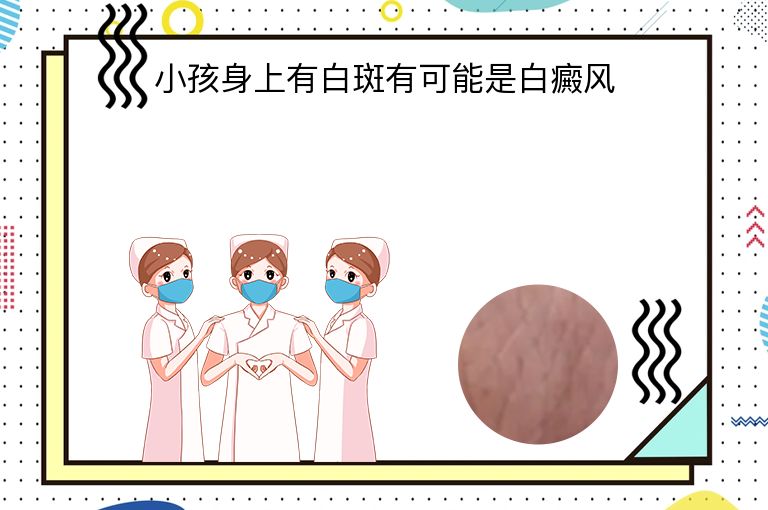 https://www.bdfsjzyy.com/d/file/p/a23556169ef990b4936e1779151a4888.jpeg