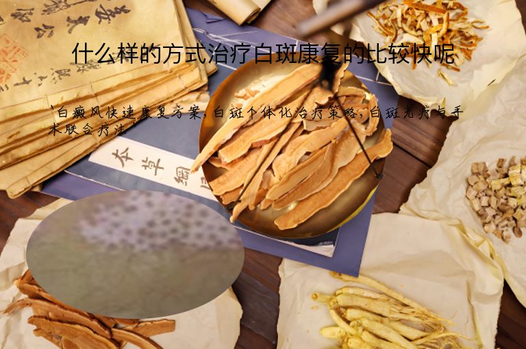 什么样的方式治疗白斑康复的比较快呢