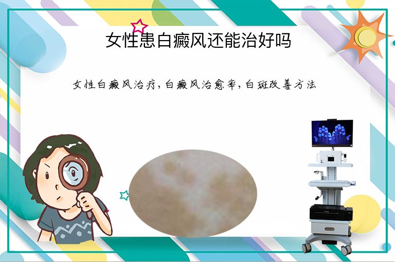 女性患白癜风还能治好吗”